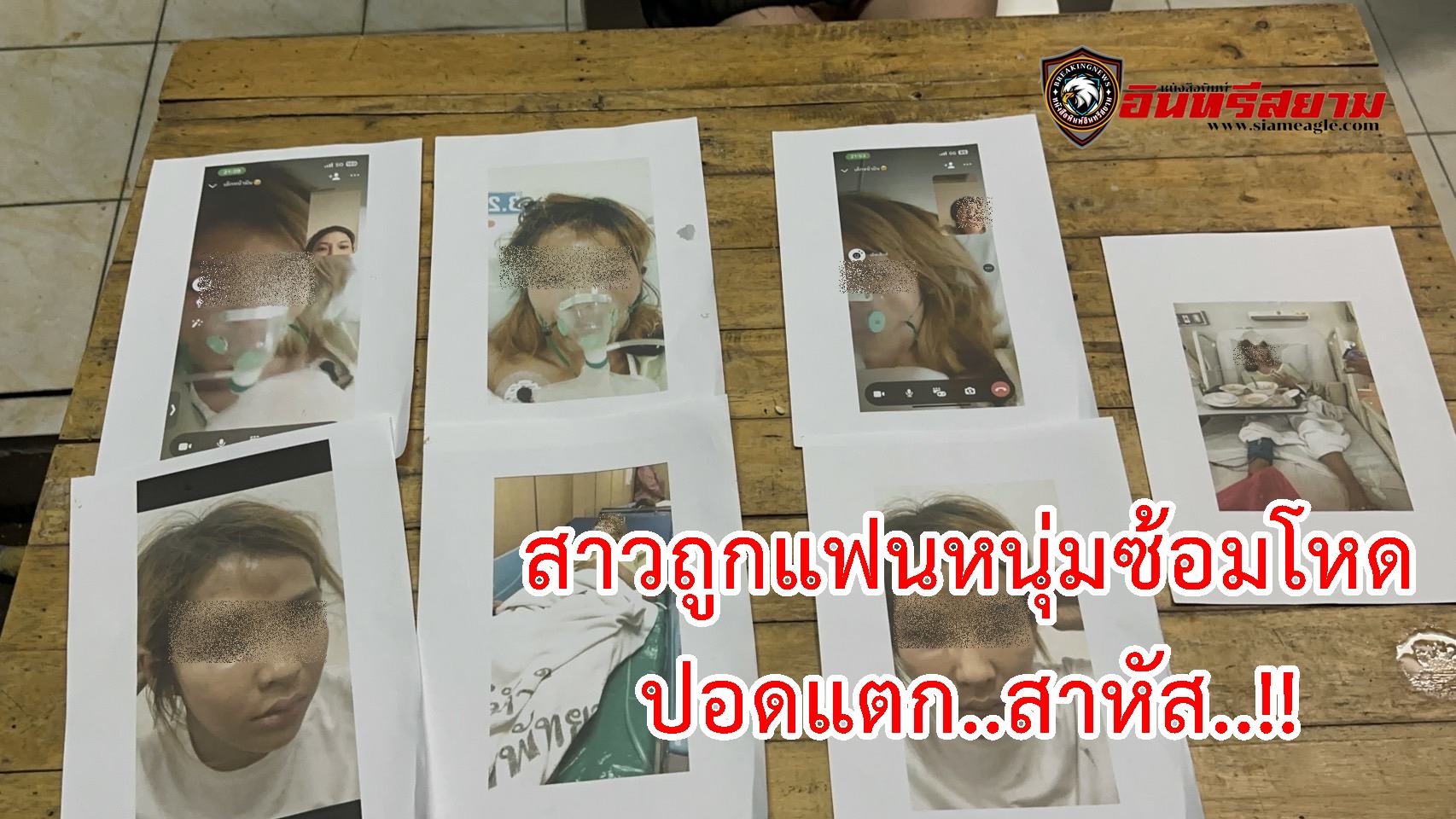 ชลบุรี-สาวถูกแฟนหนุ่มซ้อมโหด ปอดแตก..สาหัส..!!